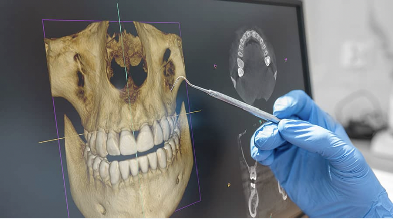 3D CBCT imaging review