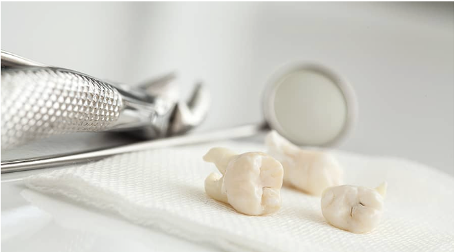 Extracted teeth with surgical instruments